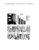 Galectin-3 Inhibitor (Gal-3M) is Associated with Additive Anti-Myeloma and     Anti-Solid Tumor Effects, Decreased Osteoclastogenesis and Organ     Protection when Used in Combination with Proteasome Inhibitors diagram and image