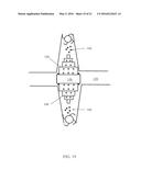 PROPPANT AND PROPPANT DELIVERY SYSTEM diagram and image