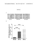 REPLICATION FACTOR C-40 (RFC40/RFC2) AS A PROGNOSTIC MARKER AND TARGET IN     ESTROGEN POSITIVE AND NEGATIVE AND TRIPLE NEGATIVE BREAST CANCER diagram and image