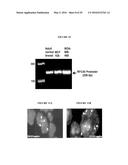 REPLICATION FACTOR C-40 (RFC40/RFC2) AS A PROGNOSTIC MARKER AND TARGET IN     ESTROGEN POSITIVE AND NEGATIVE AND TRIPLE NEGATIVE BREAST CANCER diagram and image