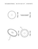 METHODS AND SYSTEMS FOR DELIVERING AN IMPLANT USING A PLANETARY GEAR     ACTUATION ASSEMBLY diagram and image