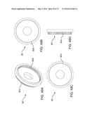 METHODS AND SYSTEMS FOR DELIVERING AN IMPLANT USING A PLANETARY GEAR     ACTUATION ASSEMBLY diagram and image