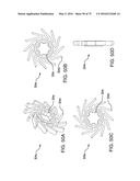 METHODS AND SYSTEMS FOR DELIVERING AN IMPLANT USING A PLANETARY GEAR     ACTUATION ASSEMBLY diagram and image