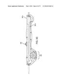 METHODS AND SYSTEMS FOR DELIVERING AN IMPLANT USING A PLANETARY GEAR     ACTUATION ASSEMBLY diagram and image