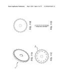 METHODS AND SYSTEMS FOR DELIVERING AN IMPLANT USING A PLANETARY GEAR     ACTUATION ASSEMBLY diagram and image