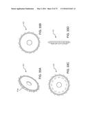 METHODS AND SYSTEMS FOR DELIVERING AN IMPLANT USING A PLANETARY GEAR     ACTUATION ASSEMBLY diagram and image