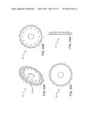 METHODS AND SYSTEMS FOR DELIVERING AN IMPLANT USING A PLANETARY GEAR     ACTUATION ASSEMBLY diagram and image