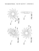 METHODS AND SYSTEMS FOR DELIVERING AN IMPLANT USING A PLANETARY GEAR     ACTUATION ASSEMBLY diagram and image