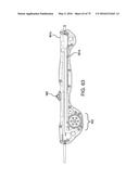 METHODS AND SYSTEMS FOR DELIVERING AN IMPLANT USING A PLANETARY GEAR     ACTUATION ASSEMBLY diagram and image