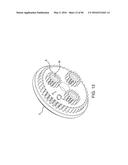 METHODS AND SYSTEMS FOR DELIVERING AN IMPLANT USING A PLANETARY GEAR     ACTUATION ASSEMBLY diagram and image