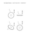 METHODS AND SYSTEMS FOR DELIVERING AN IMPLANT USING A PLANETARY GEAR     ACTUATION ASSEMBLY diagram and image