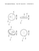 METHODS AND SYSTEMS FOR DELIVERING AN IMPLANT USING A PLANETARY GEAR     ACTUATION ASSEMBLY diagram and image