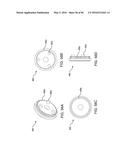 METHODS AND SYSTEMS FOR DELIVERING AN IMPLANT USING A PLANETARY GEAR     ACTUATION ASSEMBLY diagram and image