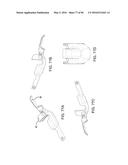 METHODS AND SYSTEMS FOR DELIVERING AN IMPLANT USING A PLANETARY GEAR     ACTUATION ASSEMBLY diagram and image