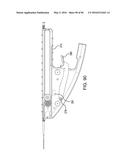 METHODS AND SYSTEMS FOR DELIVERING AN IMPLANT USING A PLANETARY GEAR     ACTUATION ASSEMBLY diagram and image