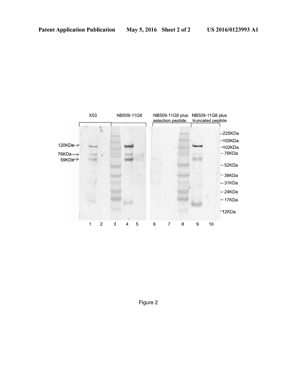 Collagen Type X Alpha-1 Assay - diagram, schematic, and image 03