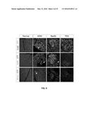 SCREEN AND USE OF THERAPEUTICS FOR PANCREATIC DUCTAL ADENOCARCINOMA diagram and image