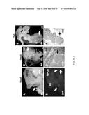 SCREEN AND USE OF THERAPEUTICS FOR PANCREATIC DUCTAL ADENOCARCINOMA diagram and image