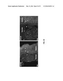 SCREEN AND USE OF THERAPEUTICS FOR PANCREATIC DUCTAL ADENOCARCINOMA diagram and image