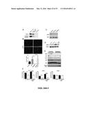 SCREEN AND USE OF THERAPEUTICS FOR PANCREATIC DUCTAL ADENOCARCINOMA diagram and image