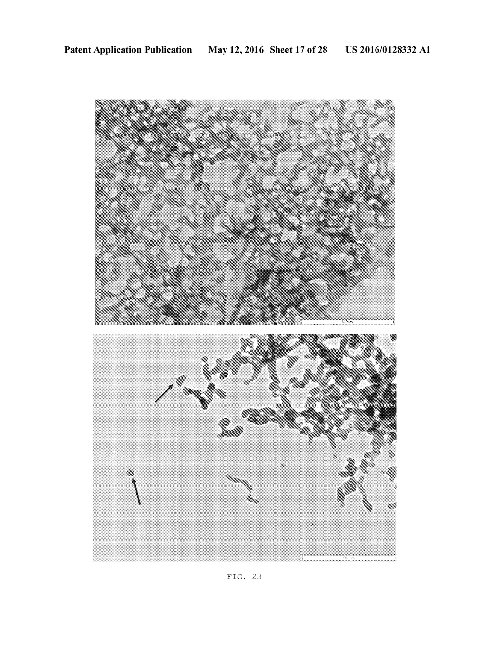 ANTIBACTERIAL MICRO- AND NANOPARTICLES COMPRISING A CHLORHEXIDINE SALT,     METHOD OF PRODUCTION AND USES THEREOF - diagram, schematic, and image 18