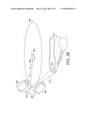 CONDITIONALLY VISIBLE BITE LINES FOR FOOTWEAR diagram and image