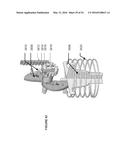 MEDICAL DEVICE INSERTERS AND PROCESSES OF INSERTING AND USING MEDICAL     DEVICES diagram and image