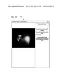 SYSTEMS AND METHODS FOR DETERMINING HEPATIC FUNCTION FROM LIVER SCANS diagram and image