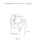 METHOD AND APPARATUS FOR ATTACHING TISSUE TO BONE, INCLUDING THE PROVISION     AND USE OF A NOVEL KNOTLESS SUTURE ANCHOR SYSTEM, INCLUDING A NOVEL     LOCKING ELEMENT diagram and image