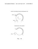 METHOD AND APPARATUS FOR ATTACHING TISSUE TO BONE, INCLUDING THE PROVISION     AND USE OF A NOVEL KNOTLESS SUTURE ANCHOR SYSTEM, INCLUDING A NOVEL     LOCKING ELEMENT diagram and image