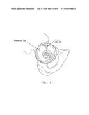 METHOD AND APPARATUS FOR ATTACHING TISSUE TO BONE, INCLUDING THE PROVISION     AND USE OF A NOVEL KNOTLESS SUTURE ANCHOR SYSTEM, INCLUDING A NOVEL     LOCKING ELEMENT diagram and image