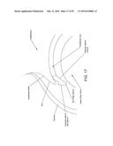 METHOD AND APPARATUS FOR ATTACHING TISSUE TO BONE, INCLUDING THE PROVISION     AND USE OF A NOVEL KNOTLESS SUTURE ANCHOR SYSTEM, INCLUDING A NOVEL     LOCKING ELEMENT diagram and image