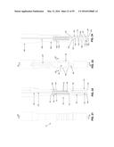 METHOD AND APPARATUS FOR ATTACHING TISSUE TO BONE, INCLUDING THE PROVISION     AND USE OF A NOVEL KNOTLESS SUTURE ANCHOR SYSTEM, INCLUDING A NOVEL     LOCKING ELEMENT diagram and image