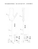 METHOD AND APPARATUS FOR ATTACHING TISSUE TO BONE, INCLUDING THE PROVISION     AND USE OF A NOVEL KNOTLESS SUTURE ANCHOR SYSTEM, INCLUDING A NOVEL     LOCKING ELEMENT diagram and image