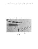 METHOD AND APPARATUS FOR ATTACHING TISSUE TO BONE, INCLUDING THE PROVISION     AND USE OF A NOVEL KNOTLESS SUTURE ANCHOR SYSTEM, INCLUDING A NOVEL     LOCKING ELEMENT diagram and image