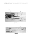 METHOD AND APPARATUS FOR ATTACHING TISSUE TO BONE, INCLUDING THE PROVISION     AND USE OF A NOVEL KNOTLESS SUTURE ANCHOR SYSTEM, INCLUDING A NOVEL     LOCKING ELEMENT diagram and image