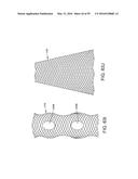 METHOD AND APPARATUS FOR ATTACHING TISSUE TO BONE, INCLUDING THE PROVISION     AND USE OF A NOVEL KNOTLESS SUTURE ANCHOR SYSTEM, INCLUDING A NOVEL     LOCKING ELEMENT diagram and image