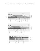 METHOD AND APPARATUS FOR ATTACHING TISSUE TO BONE, INCLUDING THE PROVISION     AND USE OF A NOVEL KNOTLESS SUTURE ANCHOR SYSTEM, INCLUDING A NOVEL     LOCKING ELEMENT diagram and image