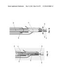 METHOD AND APPARATUS FOR ATTACHING TISSUE TO BONE, INCLUDING THE PROVISION     AND USE OF A NOVEL KNOTLESS SUTURE ANCHOR SYSTEM, INCLUDING A NOVEL     LOCKING ELEMENT diagram and image