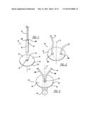 FLEXIBLE PLANAR MEMBER FOR TISSUE FIXATION diagram and image