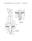 FLEXIBLE PLANAR MEMBER FOR TISSUE FIXATION diagram and image