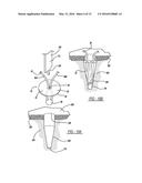 FLEXIBLE PLANAR MEMBER FOR TISSUE FIXATION diagram and image