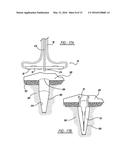 FLEXIBLE PLANAR MEMBER FOR TISSUE FIXATION diagram and image