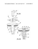 FLEXIBLE PLANAR MEMBER FOR TISSUE FIXATION diagram and image