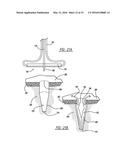 FLEXIBLE PLANAR MEMBER FOR TISSUE FIXATION diagram and image