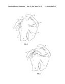 METHODS AND APPARATUS FOR FIXING SHEET-LIKE MATERIALS TO A TARGET TISSUE diagram and image