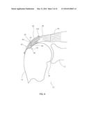 METHODS AND APPARATUS FOR FIXING SHEET-LIKE MATERIALS TO A TARGET TISSUE diagram and image