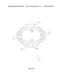 METHODS AND APPARATUS FOR FIXING SHEET-LIKE MATERIALS TO A TARGET TISSUE diagram and image