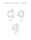 HEX CAPTURE FOR SELF EXPANDING AND DRIVEN OCCLUDER diagram and image