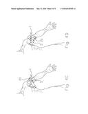 BATTLE APPLICATION TOURNIQUET FOR LIMB diagram and image